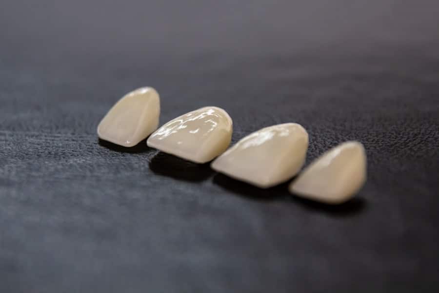 Dental Implants