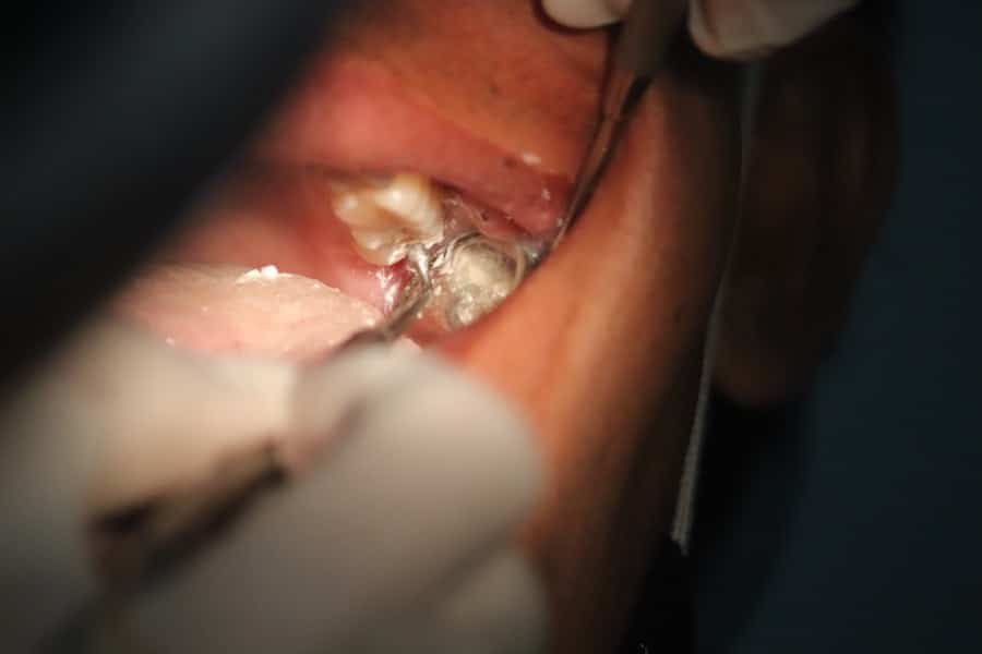 Oral Surgeon