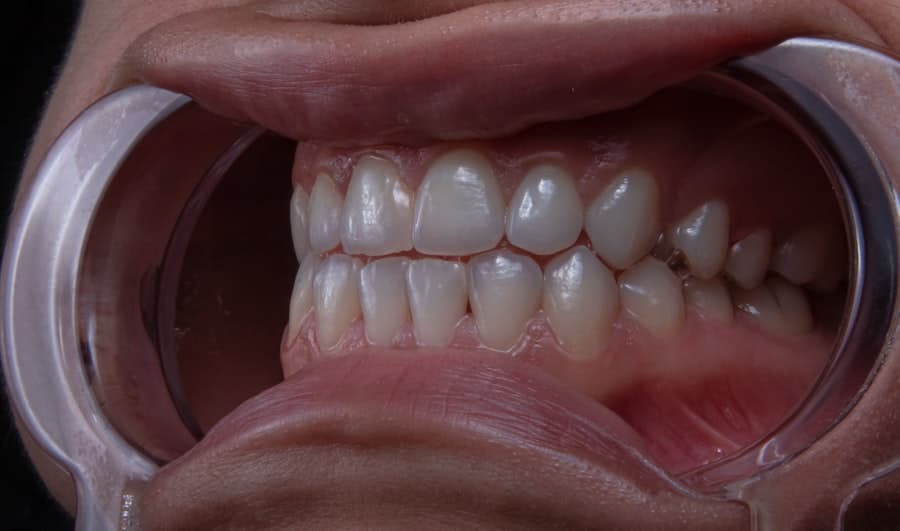 Family Dentist Chandler Az
