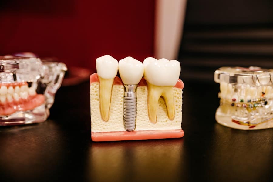 Preventive Dental Care Frisco Tx 2 Dental Care