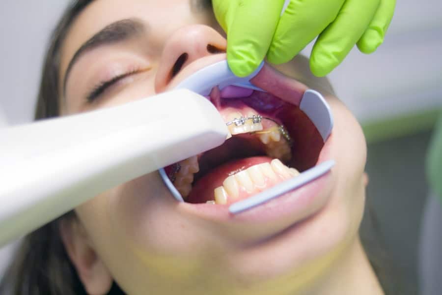 Dental Cleaning