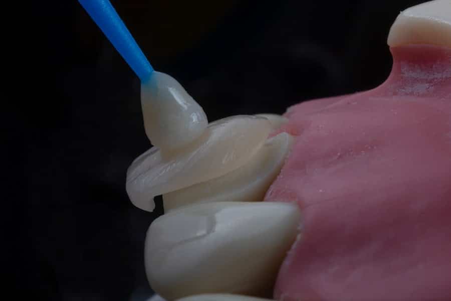 Photo Dental Cleanings