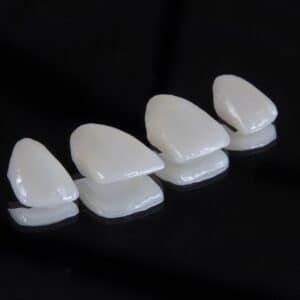 Photo Dental Implants