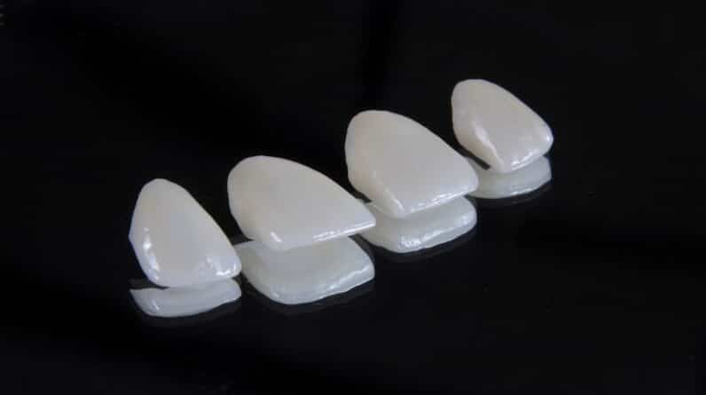 Photo Dental Implants