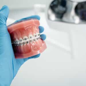 Photo Dental Implants Cost