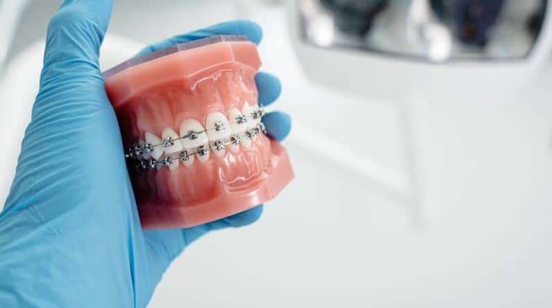 Photo Dental Implants Cost