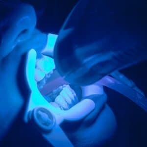 Photo Laser Dental Surgery