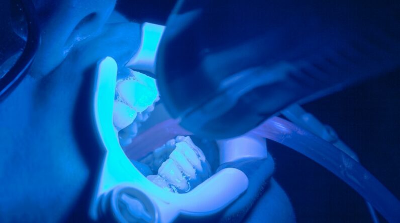 Photo Laser Dental Surgery