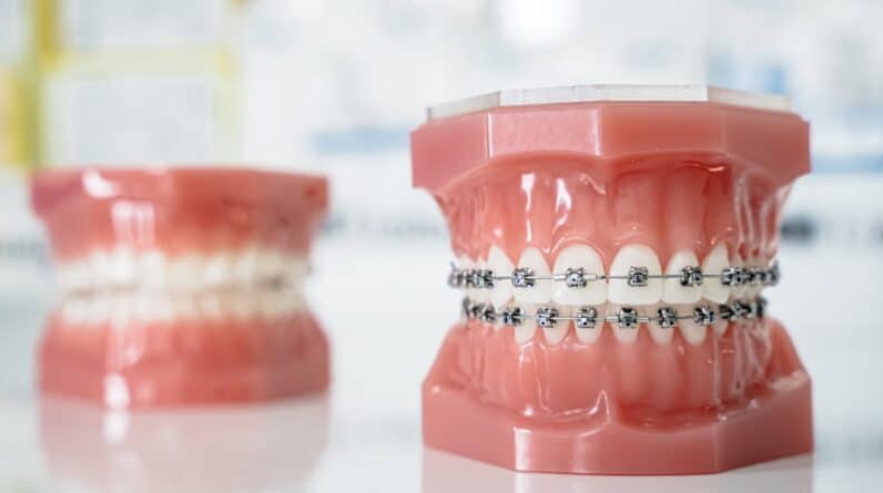Photo Dental Implants