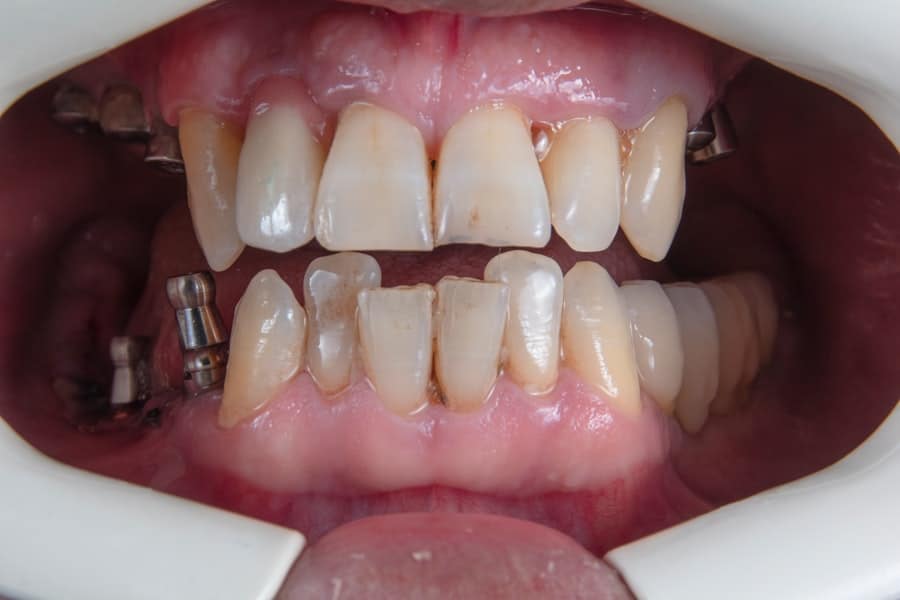 Photo Oral Surgery