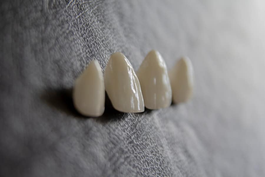 Photo Cost of Dental Implants