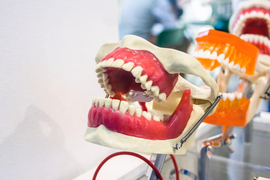 Photo Dentist Frisco Tx