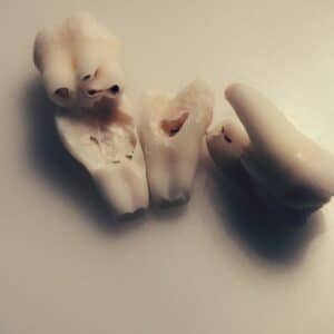 Photo Periodontist