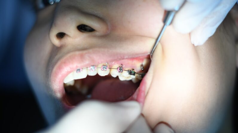 Photo Holistic Dentist Chandler Az