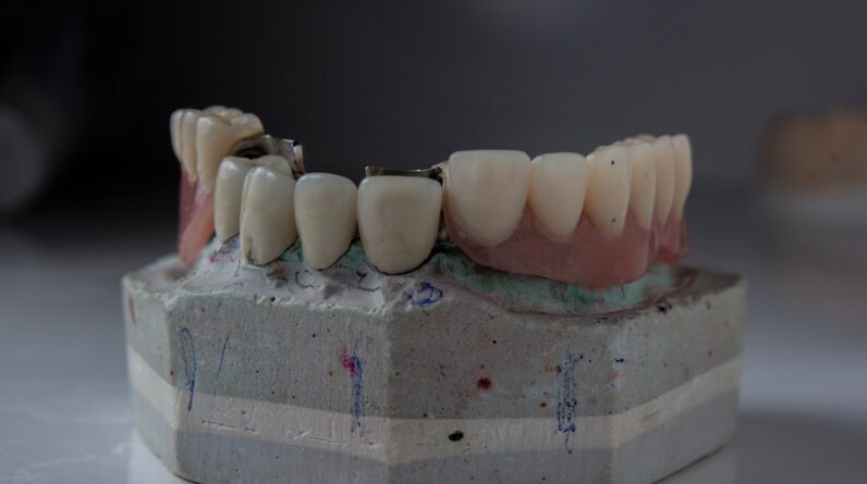 Photo Dental Fillings