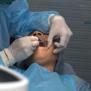 Photo Tooth Extraction Chandler Az