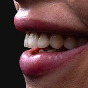 Photo Mouth Reconstruction