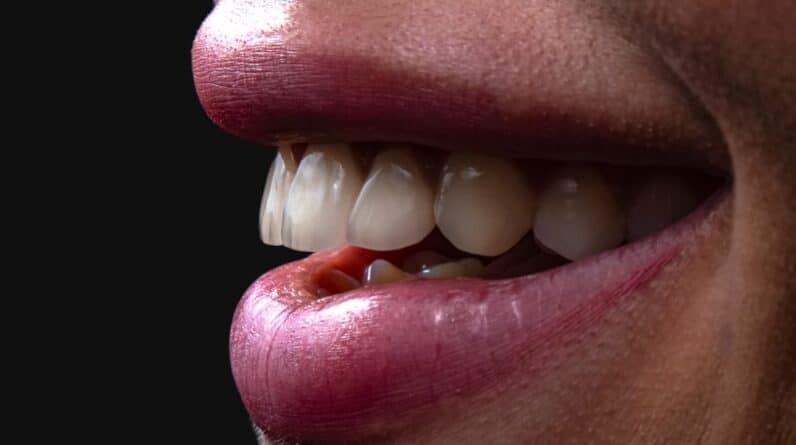Photo Mouth Reconstruction