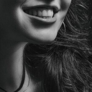Photo Smile Makeover