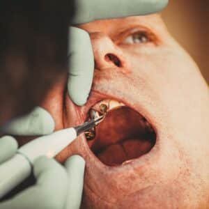 Photo Oral Surgery
