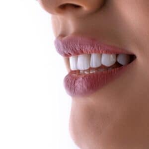 Photo Dental Implants