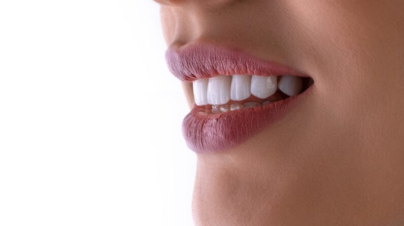 Photo Dental Implants