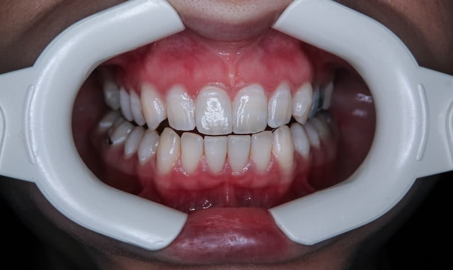 Periodontist Frisco Tx 3 Photo Periodontist