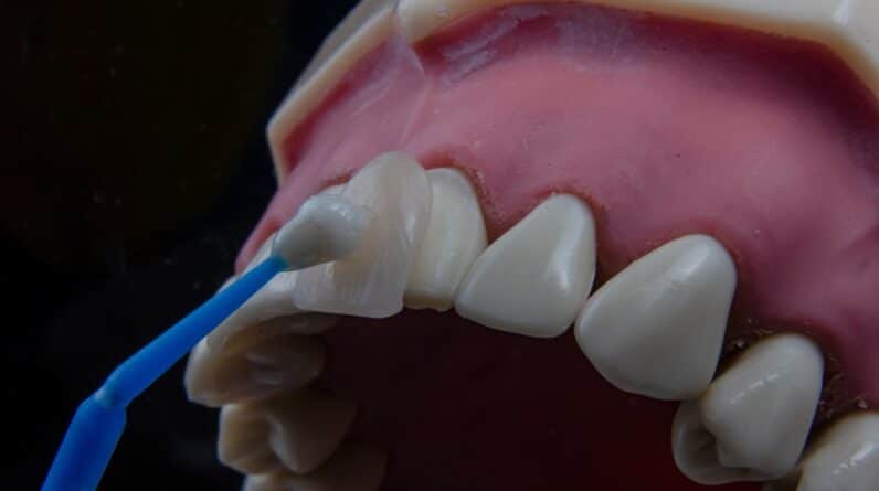 Photo Dental Fillings