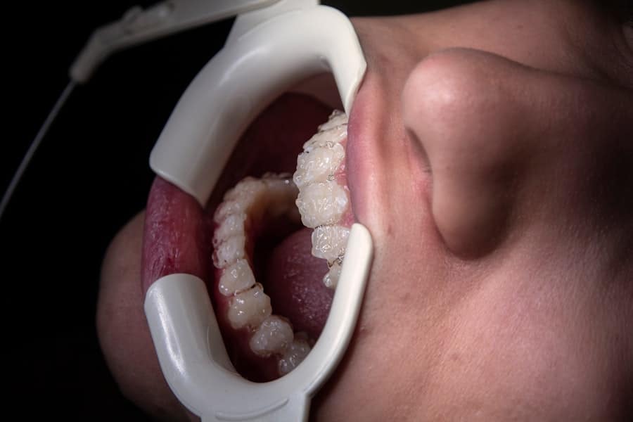 Photo Teeth Cleaning Frisco Tx