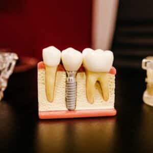 Photo Dentist